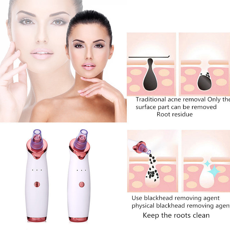 Blackhead Remover Vacuum - Acne & Pore Cleaning Tool